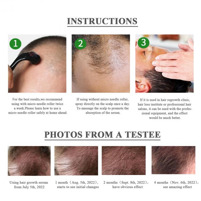 گیاه استخراج شده محصولات مراقبت از پوست سفارشی رشد موهای طبیعی سرم 80ML اثر سریع 0