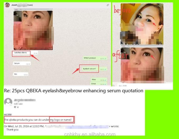 تجربه شوره های چشم طولانی تر با Bio-enzyme رشد موی موی سروم مدت عمر 3 سال 2