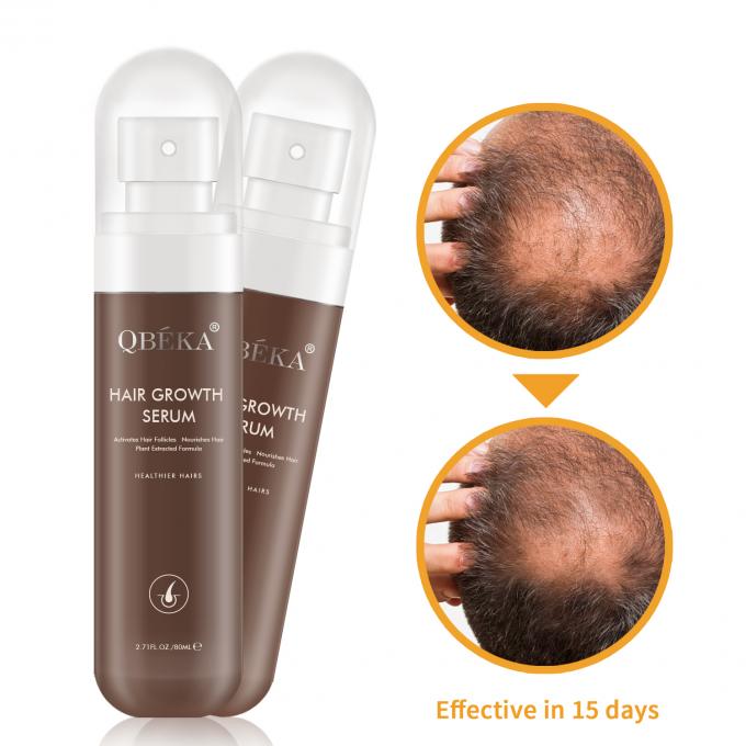 QBEKA Professional Hair Extension Lotion برای پاسخ و تغذیه فولیکول 15 روزه 2
