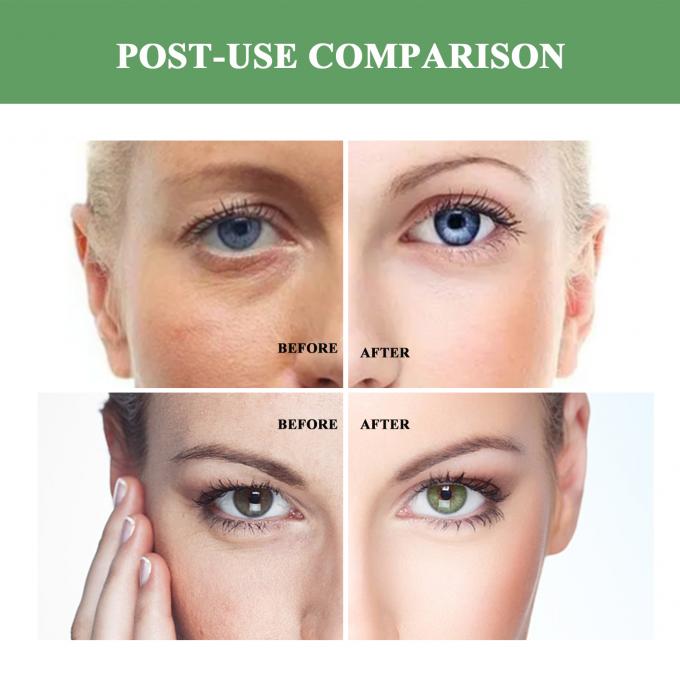 کرم ضد پیری با سایز عادی کرم ضد چروک طبیعی برای بزرگسالان 7